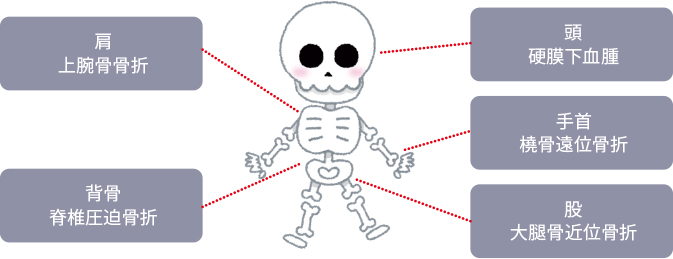 転ぶとケガをしやすい部位